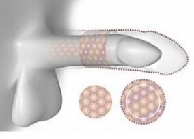 Megnövekedett pénisz térfogatban