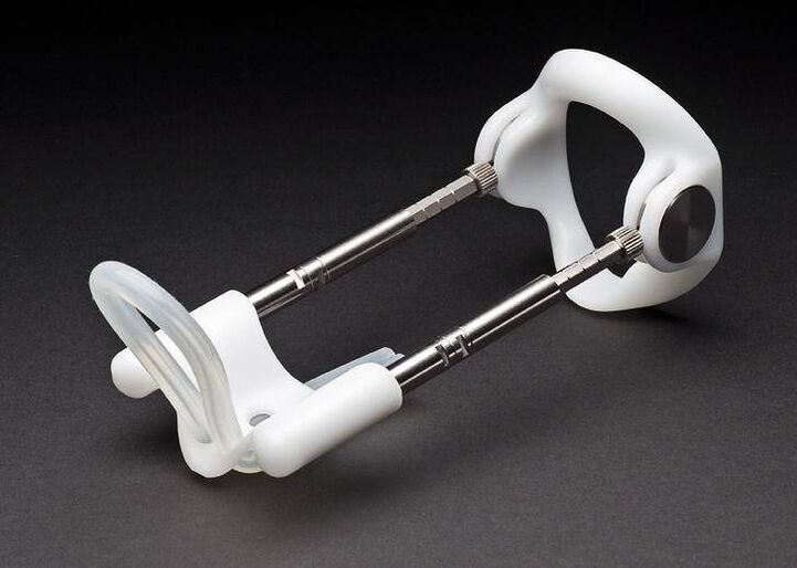 hosszabbító péniszbővítő műtét után